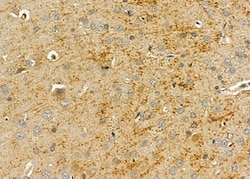Invitrogen PI3K p55 gamma Polyclonal Antibody 100 &mu;L; Unconjugated:Antibodies,