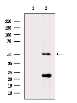 Invitrogen PI3K p55 gamma Polyclonal Antibody 100 &mu;L; Unconjugated:Antibodies,