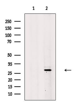 Invitrogen ING5 Polyclonal Antibody 100 &mu;L | Buy Online | Invitrogen&trade; | Fisher Scientific