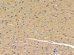 Invitrogen RASAL2 Polyclonal Antibody 100 &mu;L; Unconjugated:Antibodies,
