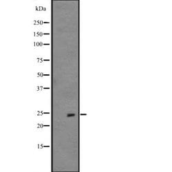 Invitrogen FGF19 Polyclonal Antibody 100 &mu;L; Unconjugated:Antibodies,