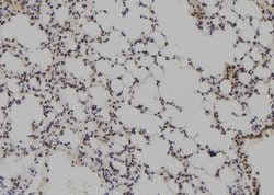 Invitrogen MAGEB5 Polyclonal Antibody 100 &mu;L | Buy Online | Invitrogen&trade; | Fisher Scientific