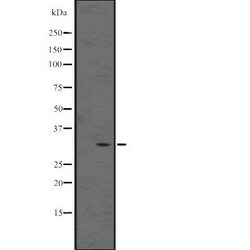Invitrogen MAGEB5 Polyclonal Antibody 100 &mu;L | Buy Online | Invitrogen&trade; | Fisher Scientific