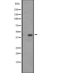 Invitrogen ACTA1/ACTA2/ACTC1 Polyclonal Antibody 100 &mu;L; Unconjugated:Antibodies,