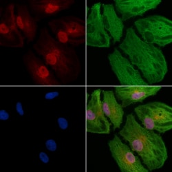 Invitrogen CSNK2A2 Polyclonal Antibody 100 &mu;L; Unconjugated:Antibodies,