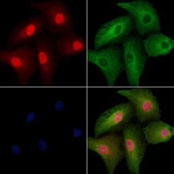Invitrogen NRK Polyclonal Antibody 100 &mu;L; Unconjugated:Antibodies,