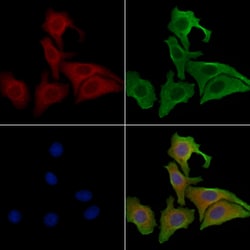 Invitrogen PRKD3 Polyclonal Antibody 100 &mu;L; Unconjugated:Antibodies,