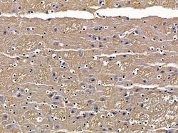 Invitrogen PRKD3 Polyclonal Antibody 100 &mu;L; Unconjugated:Antibodies,