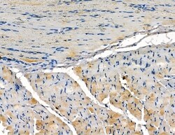 Invitrogen SRMS Polyclonal Antibody 100 &mu;L; Unconjugated:Antibodies,