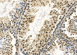 Invitrogen TSSK3 Polyclonal Antibody 100 &mu;L; Unconjugated:Antibodies,