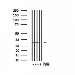 Invitrogen TSSK3 Polyclonal Antibody 100 &mu;L; Unconjugated:Antibodies,
