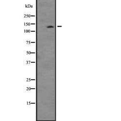 Invitrogen TTBK2 Polyclonal Antibody 100 &mu;L; Unconjugated:Antibodies,