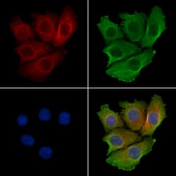 Invitrogen TRIB2 Polyclonal Antibody 100 &mu;L; Unconjugated:Antibodies,