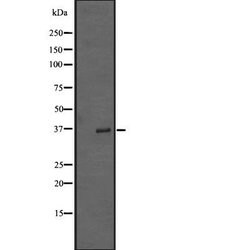 Invitrogen TRIB2 Polyclonal Antibody 100 &mu;L; Unconjugated:Antibodies,