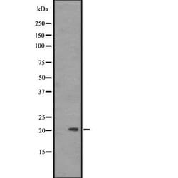 Invitrogen Placental Protein 14 Polyclonal Antibody 100 &mu;L; Unconjugated:Antibodies,