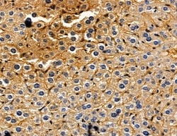 Invitrogen Kallikrein 12 Polyclonal Antibody 100 &mu;L; Unconjugated:Antibodies,