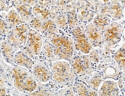 HOR5'Beta13 Polyclonal Antibody, Invitrogen 100 &mu;L | Buy Online | Thermo Scientific | Fisher Scientific