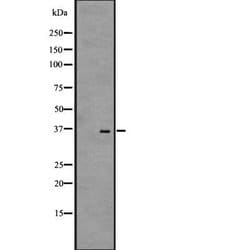 Invitrogen GPR35 Polyclonal Antibody 100 &mu;L; Unconjugated:Antibodies,
