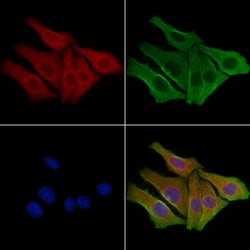 Invitrogen GPR43 Polyclonal Antibody 100 &mu;L; Unconjugated:Antibodies,