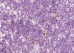 Invitrogen CXCR2 Polyclonal Antibody 100 &mu;L; Unconjugated:Antibodies,