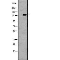 Invitrogen GPR110 Polyclonal Antibody 100 &mu;L; Unconjugated:Antibodies,