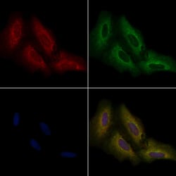 OR2T8/OR2T12/OR2T33 Polyclonal Antibody, Invitrogen 100 &mu;L; Unconjugated:Antibodies,