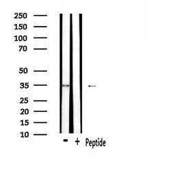 OR2T8/OR2T12/OR2T33 Polyclonal Antibody, Invitrogen 100 &mu;L; Unconjugated:Antibodies,