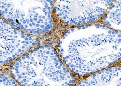Invitrogen OR1J2/OR1N2 Polyclonal Antibody 100 &mu;L; Unconjugated:Antibodies,