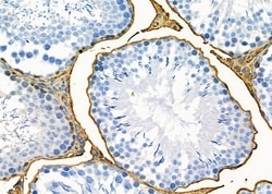 Invitrogen OR1J2/OR1N2 Polyclonal Antibody 100 &mu;L; Unconjugated:Antibodies,