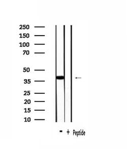 Invitrogen OR1J2/OR1N2 Polyclonal Antibody 100 &mu;L; Unconjugated:Antibodies,