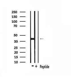 Invitrogen OR1L4/OR1L6 Polyclonal Antibody 100 &mu;L; Unconjugated:Antibodies,