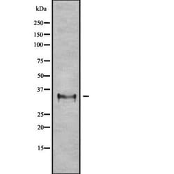 OR2L3/OR2L8 Polyclonal Antibody, Invitrogen 100 &mu;L | Buy Online | Thermo Scientific | Fisher Scientific