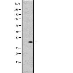Invitrogen RGR Polyclonal Antibody 100 &mu;L; Unconjugated:Antibodies,