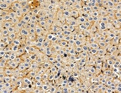 PJCG2 Polyclonal Antibody, Invitrogen 100 &mu;L; Unconjugated:Antibodies,