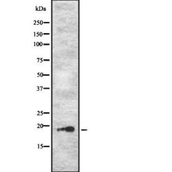 PJCG2 Polyclonal Antibody, Invitrogen 100 &mu;L; Unconjugated:Antibodies,