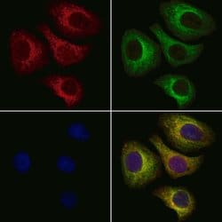 Invitrogen ALAS1 Polyclonal Antibody 100 &mu;L; Unconjugated:Antibodies,