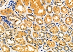 Invitrogen ALAS1 Polyclonal Antibody 100 &mu;L; Unconjugated:Antibodies,