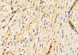 Invitrogen ALAS1 Polyclonal Antibody 100 &mu;L; Unconjugated:Antibodies,