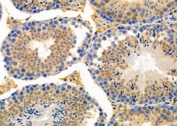 Invitrogen ALAS1 Polyclonal Antibody 100 &mu;L; Unconjugated:Antibodies,