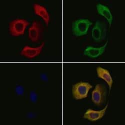 Invitrogen beta Tubulin Polyclonal Antibody 100 &mu;L; Unconjugated:Antibodies,