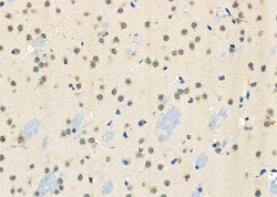 Invitrogen BRD4 Polyclonal Antibody 100 &mu;L; Unconjugated:Antibodies,