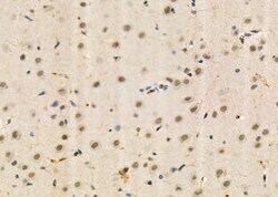 Invitrogen BRD4 Polyclonal Antibody 100 &mu;L; Unconjugated:Antibodies,