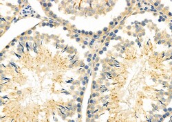 Invitrogen Enkurin Polyclonal Antibody 100 &mu;L; Unconjugated:Antibodies,