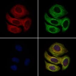 Invitrogen Enkurin Polyclonal Antibody 100 &mu;L; Unconjugated:Antibodies,