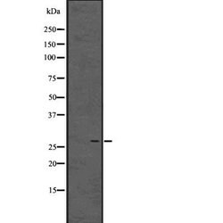 Invitrogen Enkurin Polyclonal Antibody 100 &mu;L; Unconjugated:Antibodies,