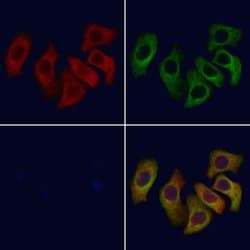 Invitrogen CCR9 Polyclonal Antibody 100 &mu;L; Unconjugated:Antibodies,