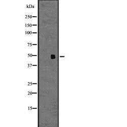 Invitrogen CCR9 Polyclonal Antibody 100 &mu;L; Unconjugated:Antibodies,