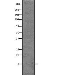 H3K14me1me2me3 Polyclonal Antibody, Invitrogen 100 &mu;L; Unconjugated:Antibodies,