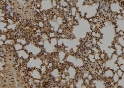 Invitrogen ID1 Polyclonal Antibody 100 &mu;L; Unconjugated:Antibodies,