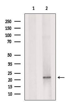Invitrogen ID1 Polyclonal Antibody 100 &mu;L; Unconjugated:Antibodies,